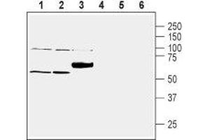 Western blot analysis of mouse lung lysate (lanes 1 and 4), rat liver lysate (lanes 2 and 5) and rat brain membranes (lanes 3 and 6): - 1-3. (SLC30A1 抗体  (C-Term, Intracellular))