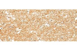 Immunohistochemistry of paraffin-embedded Human brain tissue using ZNF185 Polyclonal Antibody at dilution of 1:25(x200) (Zinc Finger Protein 185 抗体)