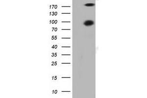 Western Blotting (WB) image for anti-Protein Kinase D2 (PKD2) antibody (ABIN1500413)