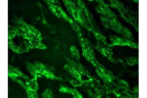 Image no. 1 for anti-Cardiotin antibody (ABIN335362) (Cardiotin 抗体)