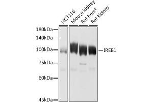 Western blot analysis of extracts of various cell lines, using IREB1 antibody (ABIN6128144, ABIN6136437, ABIN6136439 and ABIN6223846) at 1:1000 dilution. (Aconitase 1 抗体  (AA 1-170))