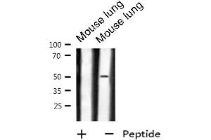 Western blot analysis of GPR180 expression in Mouse lung lysate (GPR180 抗体  (Internal Region))