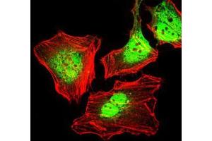 Immunofluorescence analysis of HeLa cells using CK5 mouse mAb (green). (Cytokeratin 5 抗体)