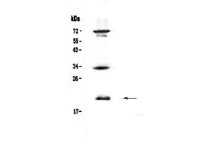 Western blot analysis of IL17B  using anti-IL17B  antibody . (IL17B 抗体  (AA 23-180))