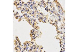 Immunohistochemistry (IHC) image for anti-Microtubule-Associated Protein 1 Light Chain 3 alpha (MAP1LC3A) antibody (ABIN1876819) (MAP1LC3A 抗体)