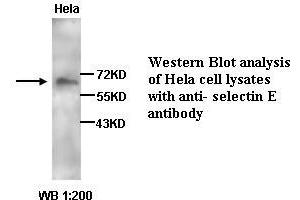Image no. 1 for anti-Selectin E (SELE) antibody (ABIN790883) (Selectin E/CD62e 抗体)