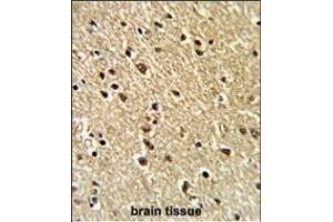 Immunohistochemistry (Paraffin-embedded Sections) (IHC (p)) image for anti-Zinc Finger Protein 36, C3H Type, Homolog (Mouse) (ZFP36) (AA 119-148) antibody (ABIN652459)