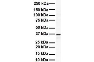 WB Suggested Anti-GAPDH antibody Titration: 1 ug/mL Sample Type: Human Raji (GAPDH 抗体  (Middle Region))