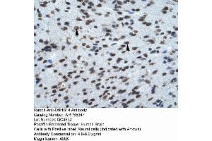 Rabbit Anti-Q9HB14 Antibody  Paraffin Embedded Tissue: Human Brain Cellular Data: Neural Cells Antibody Concentration: 4. (KCNK13 抗体  (C-Term))