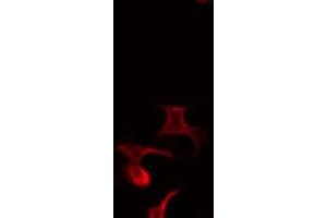ABIN6268874 staining Hela by IF/ICC. (Integrin beta 5 抗体)