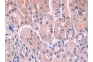 Immunohistochemistry (IHC) image for anti-Nitric Oxide Synthase Trafficker (NOSTRIN) (AA 1-245) antibody (ABIN7432256)