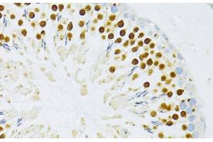 Immunohistochemistry of paraffin-embedded Rat testis using TFDP1 Polyclonal Antibody at dilution of 1:100 (40x lens). (DP1 抗体)