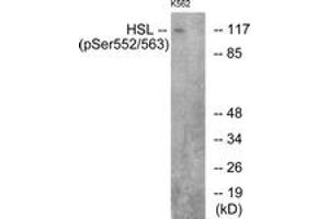 Western blot analysis of extracts from K562 cells, using HSL (Phospho-Ser552) Antibody. (LIPE 抗体  (pSer552))