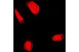 Immunofluorescent analysis of FANCC staining in U2OS cells. (FANCC 抗体)