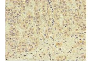 Immunohistochemistry of paraffin-embedded human adrenal gland tissue using ABIN7145562 at dilution of 1:100 (EPHX2 抗体  (AA 1-555))