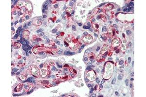 Immunohistochemistry (IHC) image for anti-NOP56 Ribonucleoprotein Homolog (NOP56) (Middle Region) antibody (ABIN2778982)