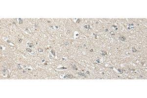 Immunohistochemistry of paraffin-embedded Human brain tissue using UCN3 Polyclonal Antibody at dilution of 1:55(x200) (UCN3 抗体)