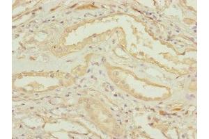 Immunohistochemistry of paraffin-embedded human kidney tissue using ABIN7147433 at dilution of 1:100 (CCDC41 抗体  (AA 34-260))