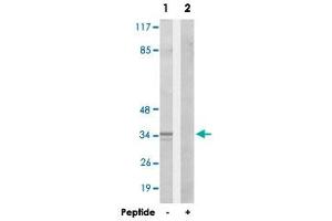 Western blot analysis of extracts from HepG2 cells, using CA13 polyclonal antibody . (CA13 抗体)