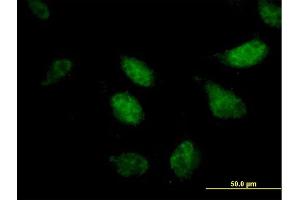 Immunofluorescence of purified MaxPab antibody to ZNF342 on HeLa cell. (Zinc Finger Protein 296 (ZNF296) (AA 1-475) 抗体)