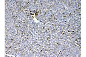 IHC analysis of HBD using anti-HBD antibody . (HBd 抗体  (AA 2-147))