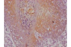 IHC image of ABIN7180967 diluted at 1:100 and staining in paraffin-embedded human tonsil tissue performed on a Leica BondTM system. (Cytokeratin 5 抗体)