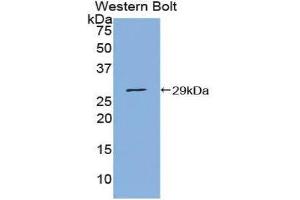 Western Blotting (WB) image for anti-Protein Inhibitor of Activated STAT, 1 (PIAS1) (AA 409-645) antibody (ABIN1860208) (PIAS1 抗体  (AA 409-645))