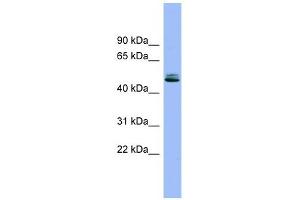 SPINT1 antibody used at 1 ug/ml to detect target protein. (SPINT1 抗体  (Middle Region))