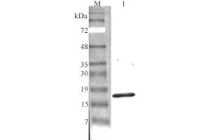 CTRP7 抗体  (Globular Domain)