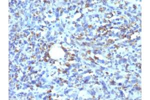 Formalin-fixed, paraffin-embedded human Histiocytoma stained with CD68 Recombinant Mouse Monoclonal Antibody (rLAMP4/824). (Recombinant CD68 抗体)