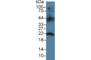 Western blot analysis of Mouse Testis lysate, using Human LCN12 Antibody (3 µg/ml) and HRP-conjugated Goat Anti-Rabbit antibody ( (LCN12 抗体  (AA 61-184))