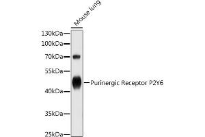 Western blot analysis of extracts of Mouse lung, using Purinergic Receptor P2Y6 antibody (ABIN3016120, ABIN3016121, ABIN3016122 and ABIN6219555) at 1:1000 dilution.