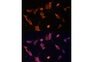 Immunofluorescence analysis of NIH-3T3 cells using UFC1 Polyclonal Antibody (ABIN6130770, ABIN6149886, ABIN6149887 and ABIN6217098) at dilution of 1:100 (40x lens). (UFC1 抗体  (AA 1-167))