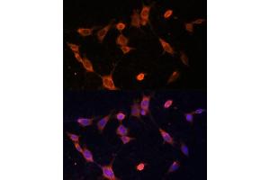 Immunofluorescence analysis of NIH-3T3 cells using UFC1 Polyclonal Antibody (ABIN6130770, ABIN6149886, ABIN6149887 and ABIN6217098) at dilution of 1:100 (40x lens). (UFC1 抗体  (AA 1-167))