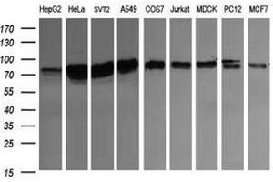 Image no. 3 for anti-CD22 Molecule (CD22) antibody (ABIN1497211) (CD22 抗体)