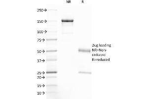 SDS-PAGE Analysis Purified CFTR Mouse Monoclonal Antibody (CFTR/1785). (CFTR 抗体  (AA 258-385))