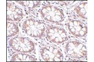 Immunohistochemistry of STEAP2 in human colon tissue with this product at 2. (STEAP2 抗体  (C-Term))