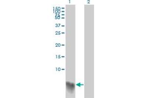 Western Blot analysis of S100A2 expression in transfected 293T cell line by S100A2 monoclonal antibody (M03A), clone 3H8. (S100A2 抗体  (AA 1-97))