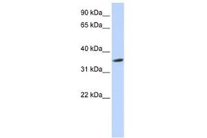 Septin 12 antibody used at 1 ug/ml to detect target protein. (Septin 12 抗体  (Middle Region))