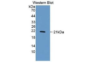 Detection of Recombinant PDGFBB, Human using Polyclonal Antibody to Platelet Derived Growth Factor BB (PDGF BB) (PDGF-BB Homodimer (AA 82-190) 抗体)