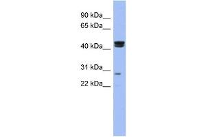 WB Suggested Anti-HSFY1 Antibody Titration:  0. (HSFY1 抗体  (N-Term))