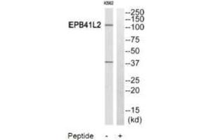 Western blot analysis of extracts from HuvEc cells and HeLa cells, using PPP2R5A antibody. (PPP2R5A 抗体)