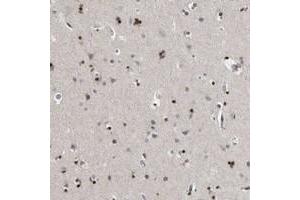 Immunohistochemical staining of human cerebral cortex with EVI5 polyclonal antibody  shows strong nuclear positivity in glial cells. (EVI5 抗体)