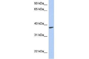 WB Suggested Anti-RTDR1 Antibody Titration: 0. (RTDR1 抗体  (Middle Region))
