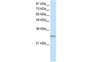 WB Suggested Anti-C20ORF20 Antibody Titration: 2. (MRGBP 抗体  (N-Term))