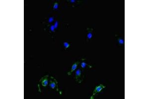 Immunofluorescent analysis of Hela cells using ABIN7159790 at dilution of 1:100 and Alexa Fluor 488-congugated AffiniPure Goat Anti-Rabbit IgG(H+L) (MAST1 抗体  (AA 687-879))
