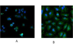 Immunofluorescence staining of MCF7 (A) and HeLa (B) cells with 5ug/ml ABIN184900 antibody. (UBE2L3 抗体  (C-Term))