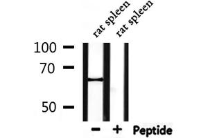 Western blot analysis of extracts from rat spleen, using PTHR1 Antibody. (PTH1R 抗体  (pThr1))