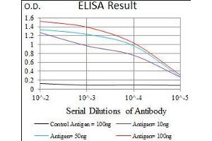 Black line: Control Antigen (100 ng), Purple line: Antigen(10 ng), Blue line: Antigen (50 ng), Red line: Antigen (100 ng), (DNAL4 抗体  (AA 1-105))