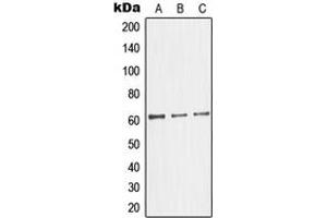 Western blot analysis of Glycerol Kinase 2 expression in HepG2 (A), HeLa (B), Jurkat (C) whole cell lysates. (GK2 抗体  (Center))